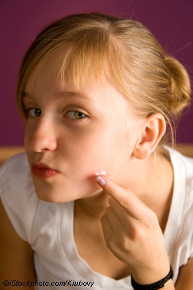 Acne photo